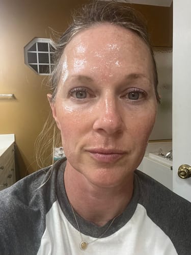 Cinthya before and after