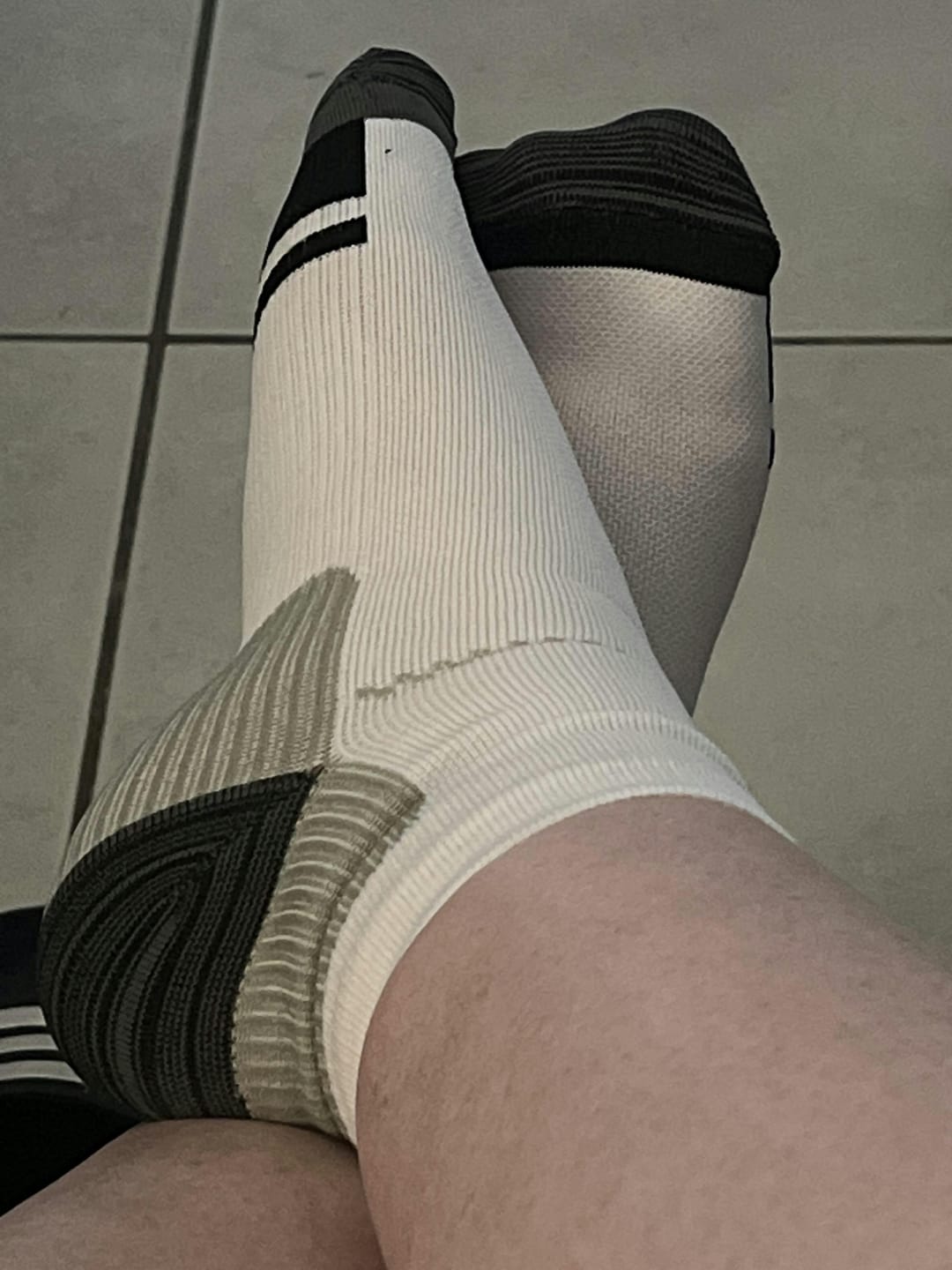 Customer photo review of Orthofabrik® Kompressionssocken PRO 2.0