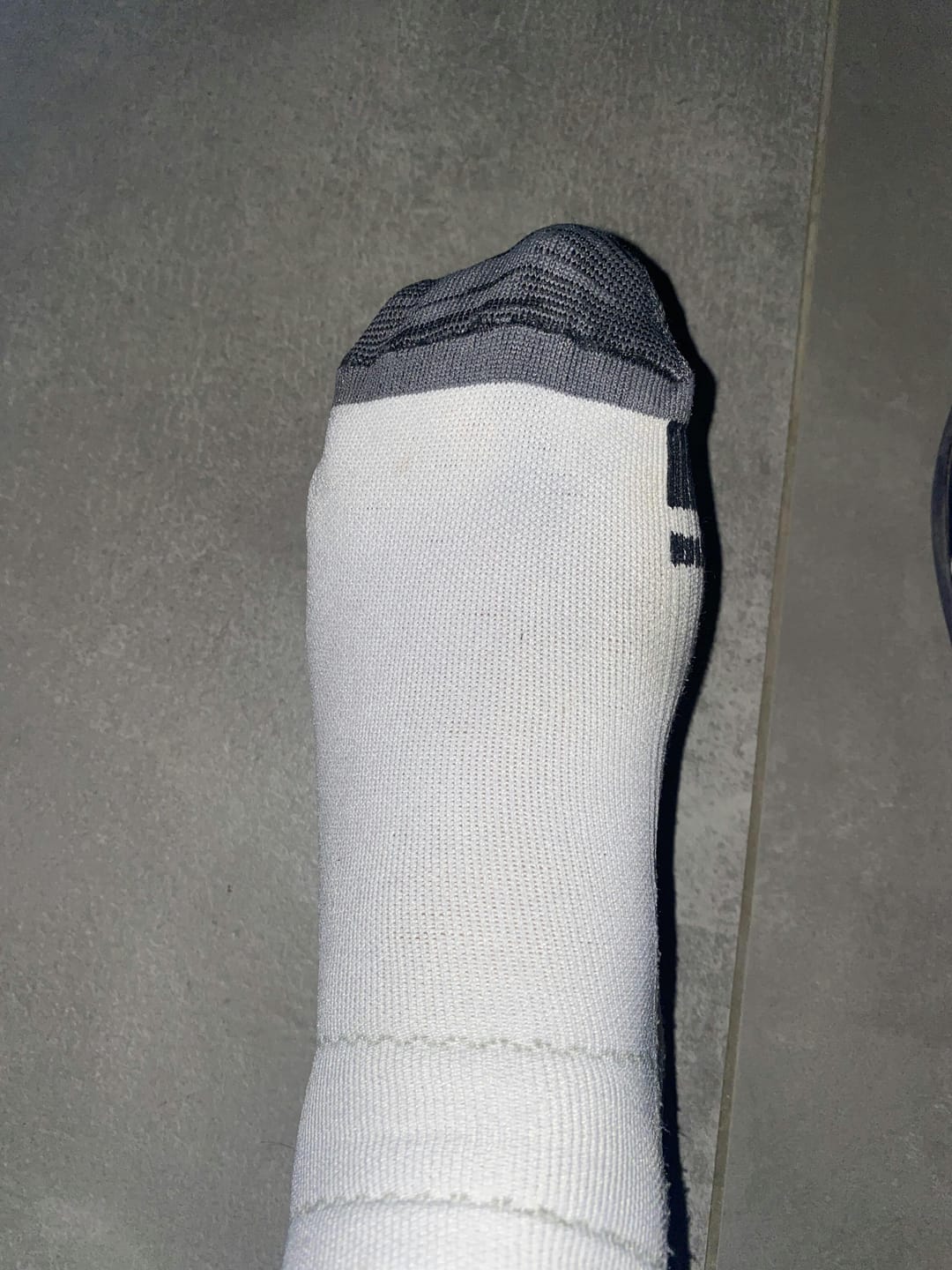 Customer photo review of Orthofabrik® Kompressionssocken PRO 2.0