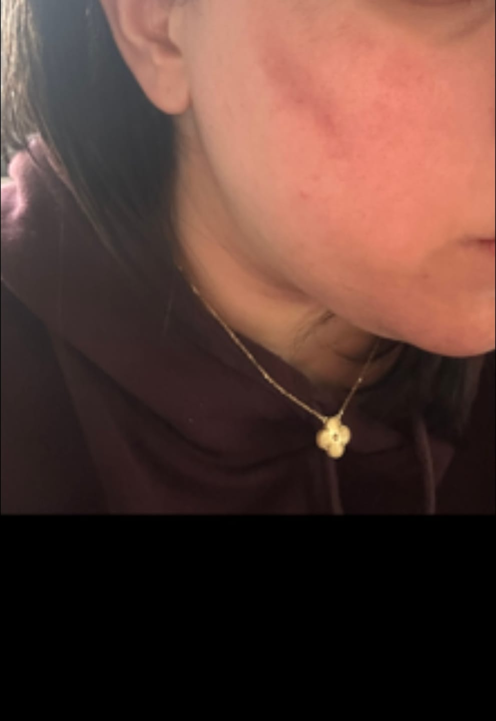 Customer photo review of ⚡ Turmeric Vitamin C Clay Mask