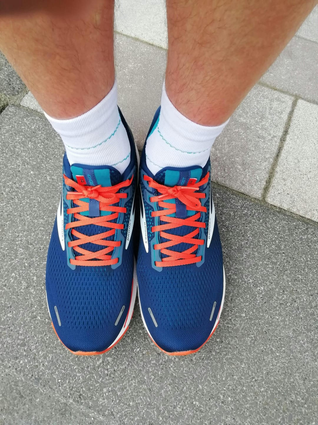 Customer photo review of Orthofabrik® Kompressionssocken PRO 2.0