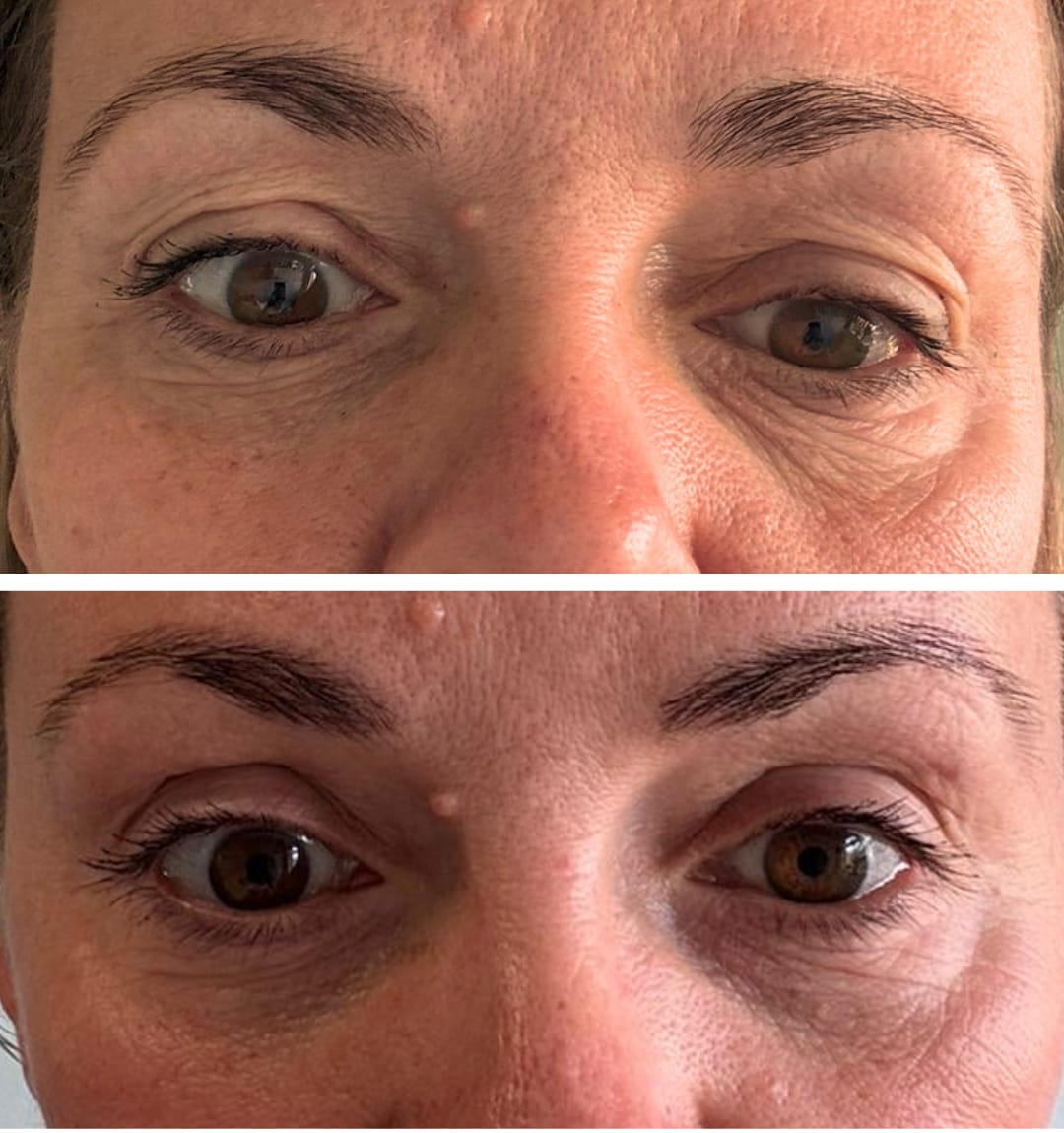 Customer photo review of Global Eye & Lip Care