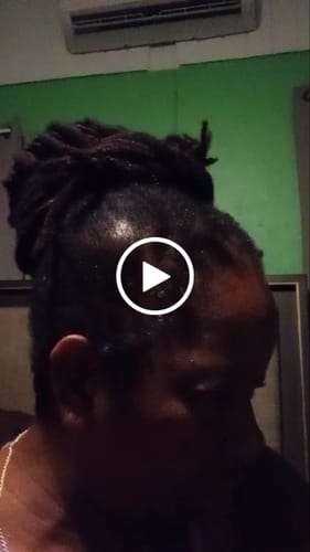 Customer video review of Three Bottles of Rennora Hair Growth Serum