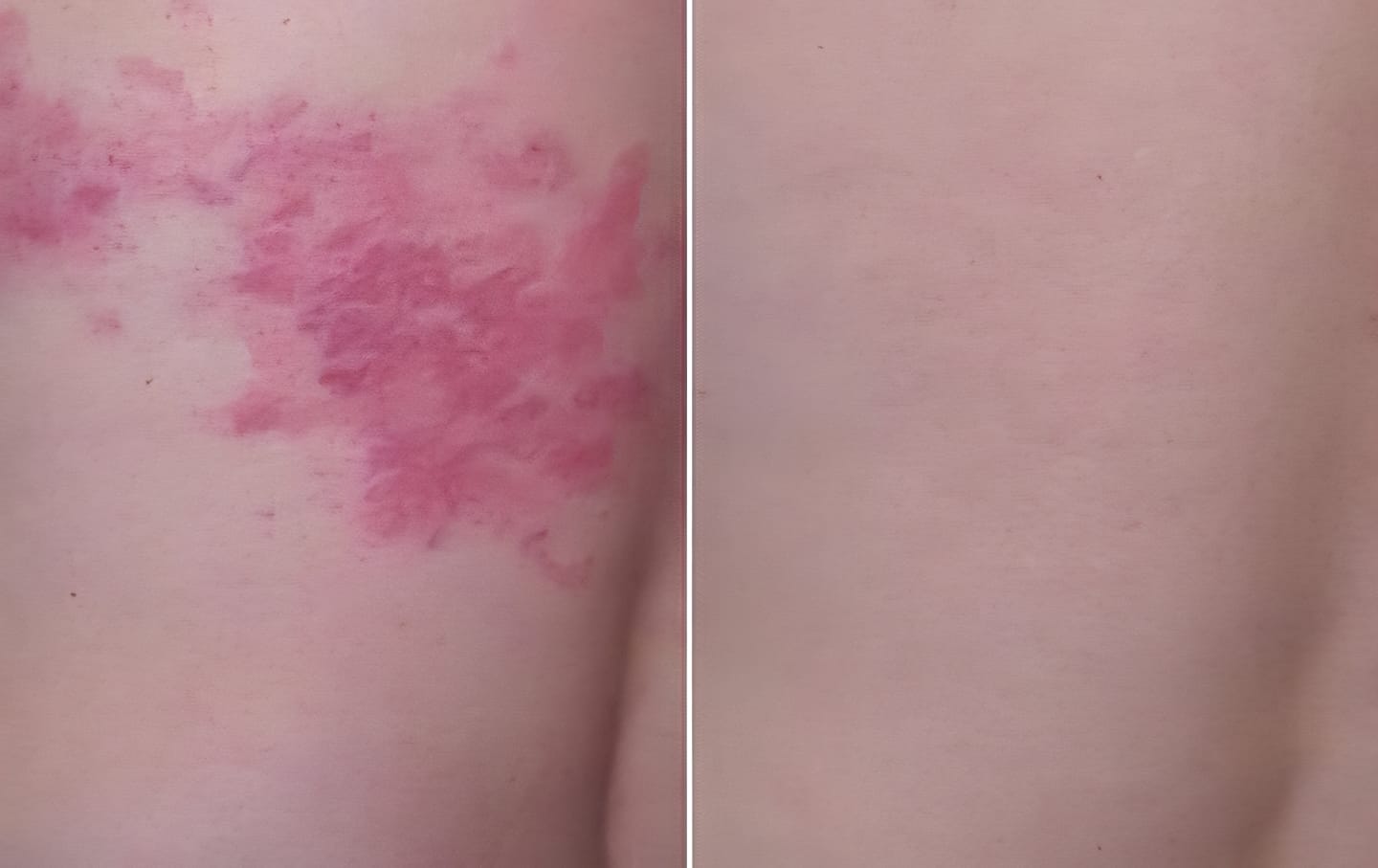 Customer photo review of Body Cream with Chia Seed Oil