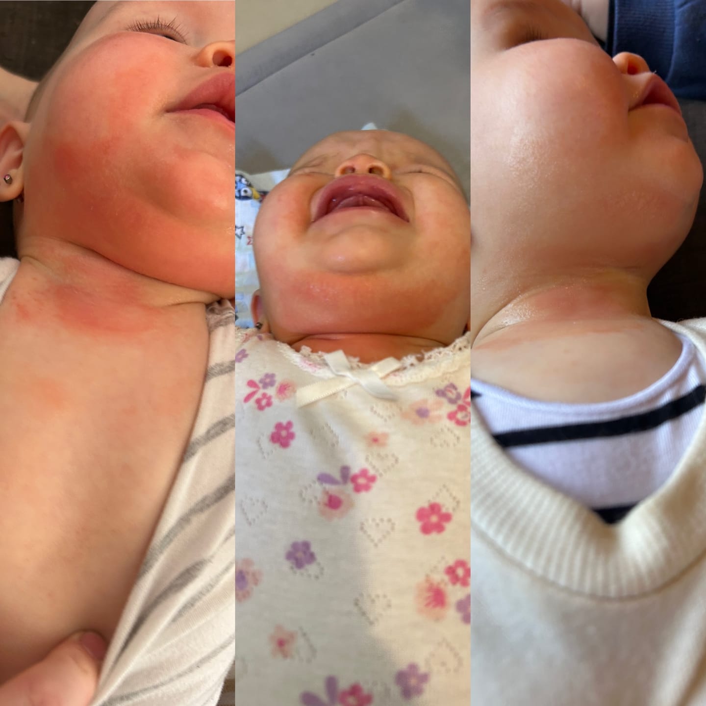 Customer photo review of Organic Barrier Balm 90g