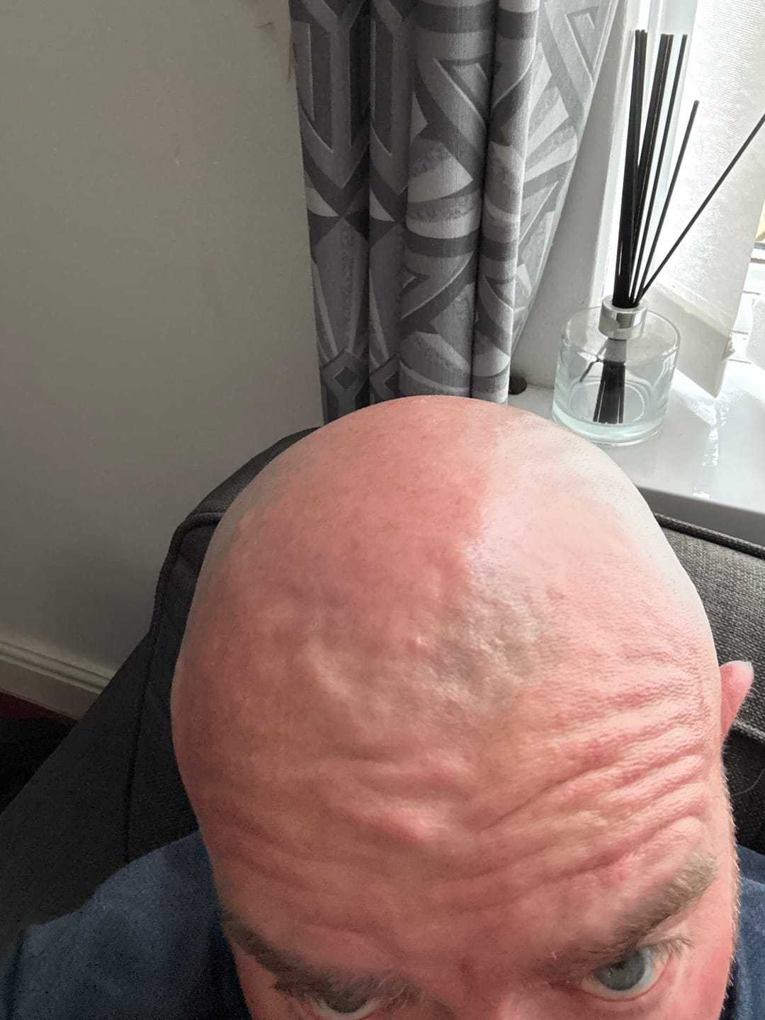 Customer photo review of 7D Floating Replacement Blade