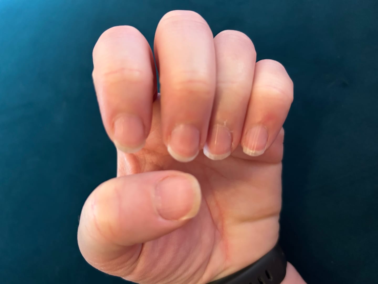 Customer photo review of Grass-Fed Collagen Peptides