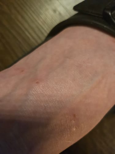 Customer photo review of FREE Restore & Revive Fix It Salve Stick - GIFT