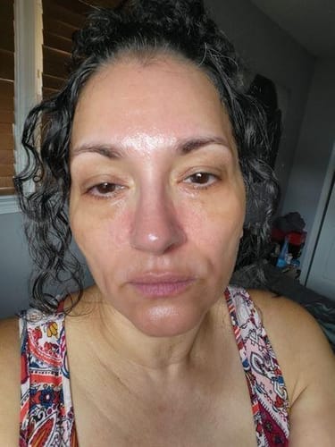 Nancy before and after