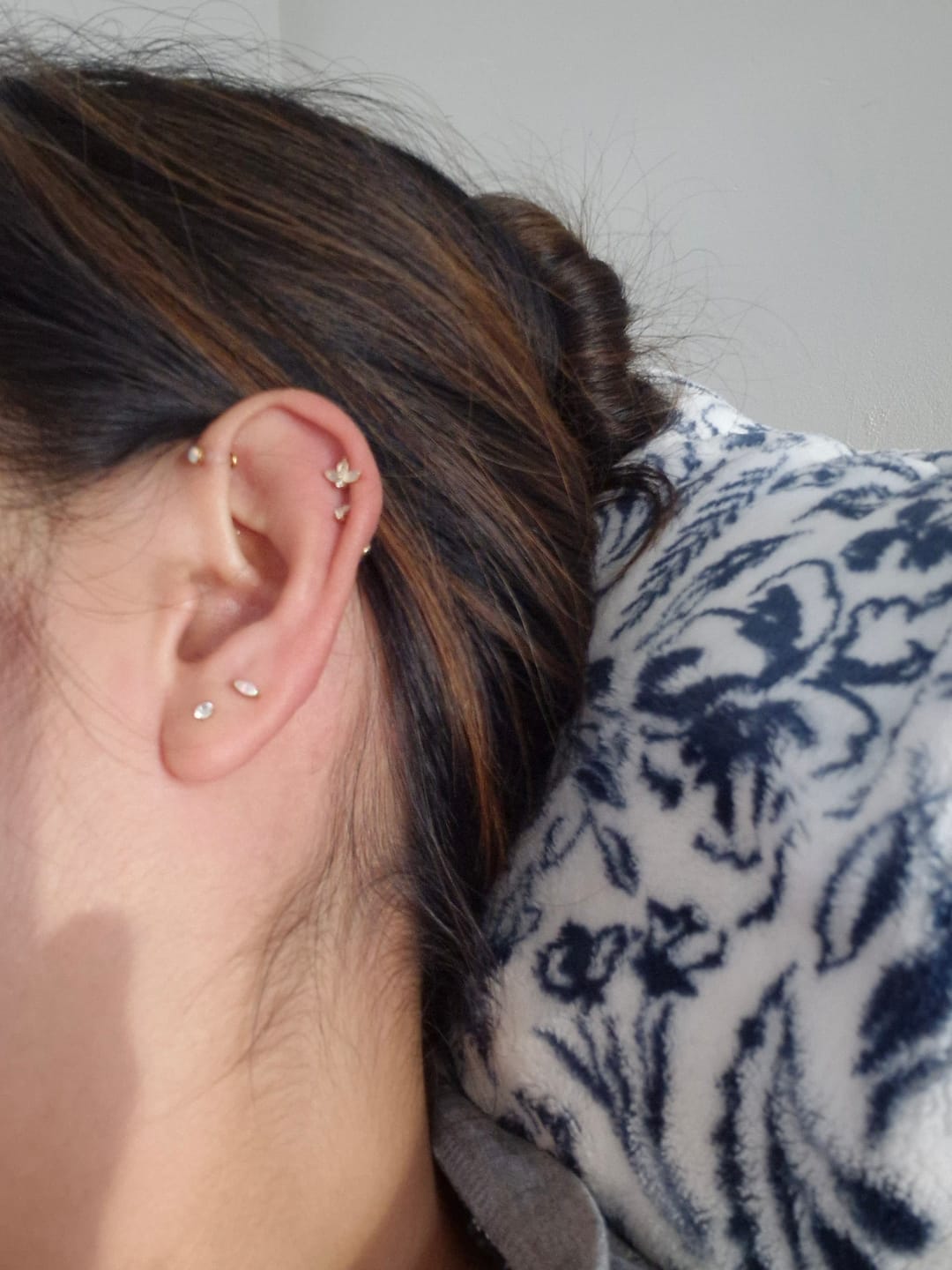Customer photo review of Threadless Titanium Cartilage Bar