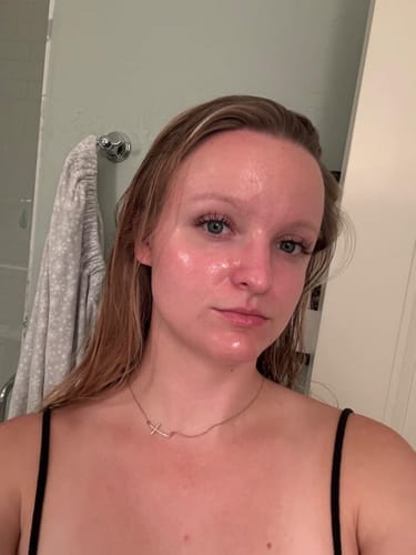 Anita before and after