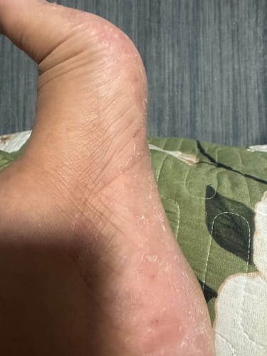 Customer photo review of Jolicare Cream