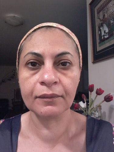 Customer photo review of Fundamental Nourishing Eye Butter