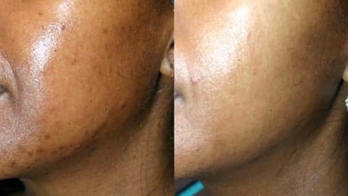 Customer photo review of Turmeric Glow Soap