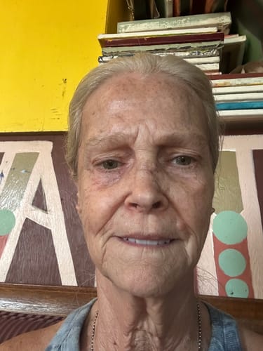 Customer photo review of Neptune Grass Fed Tallow & Honey Balm