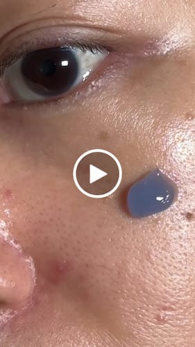 Customer photo review of Midnight Blue Clearing Water Cream