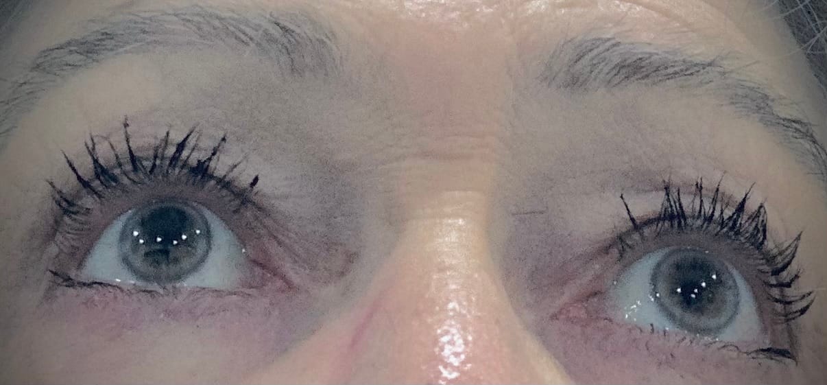 Customer photo review of Purely Lashes Lash Growth Serum