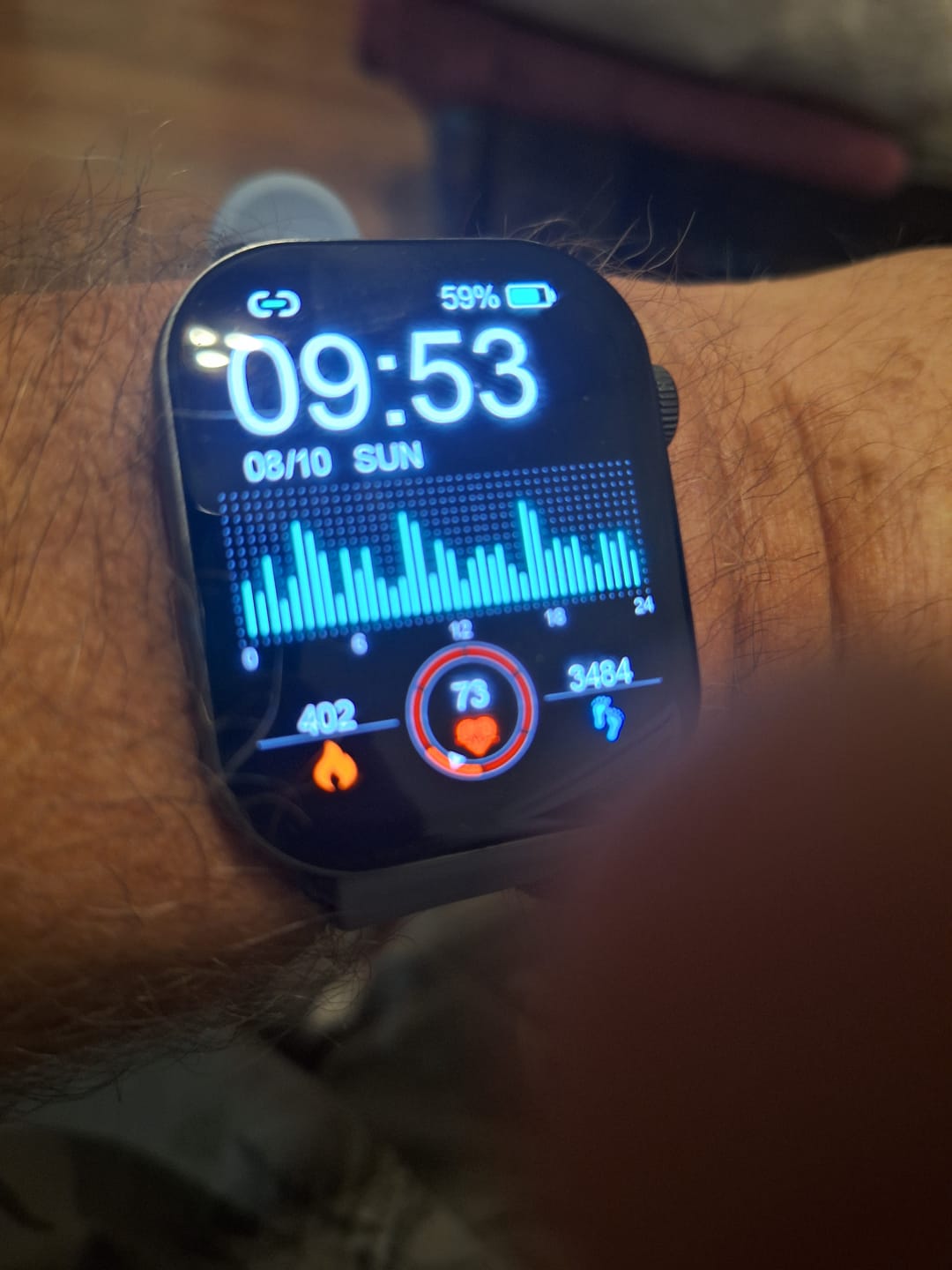 Customer photo review of Red Sport Loop