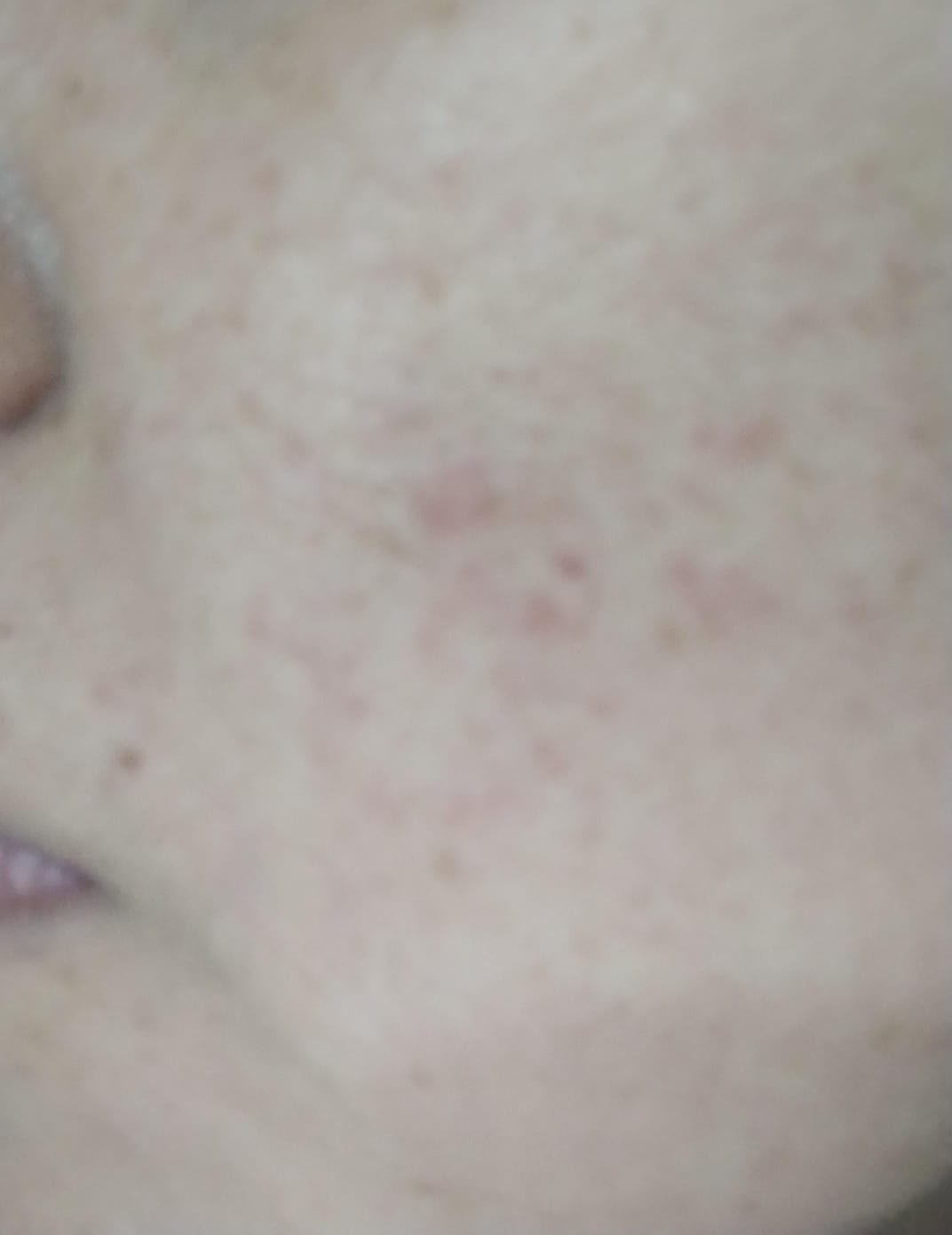 Customer photo review of Pack Revitaliza tu Rostro