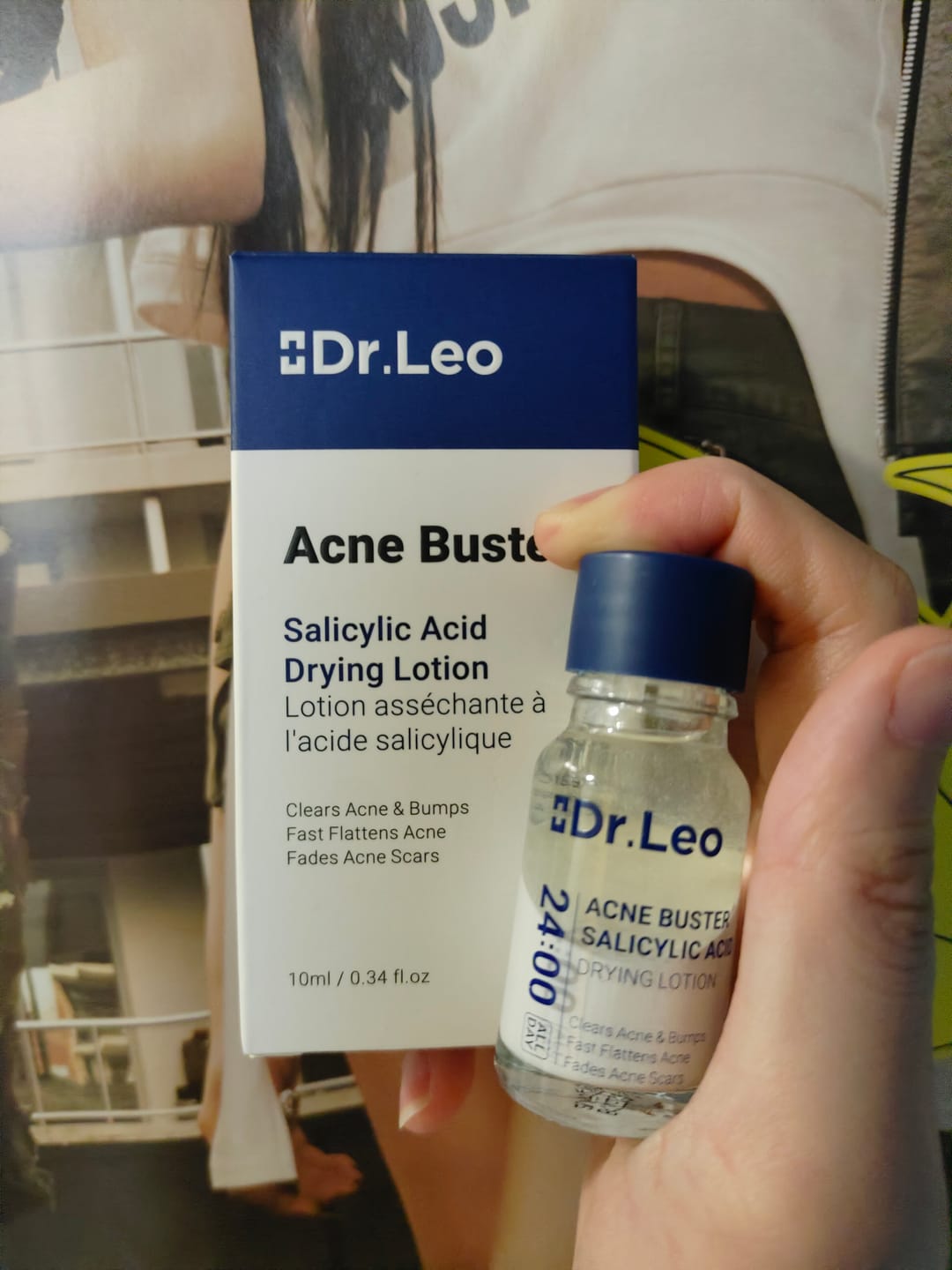 Customer photo review of Loción para el tratamiento del acné con ácido salicílico