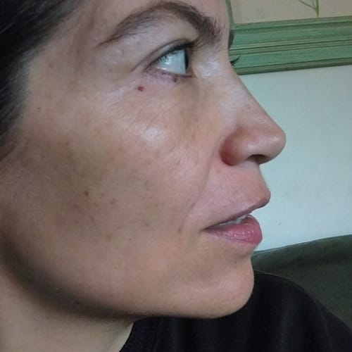 Customer photo review of Serum Activador
