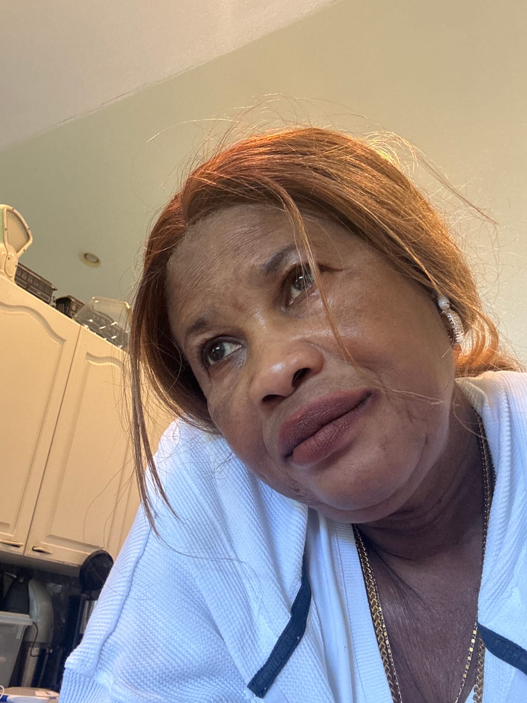 Customer photo review of 10X Cream - Facial Skin Brightening Cream - Tonique