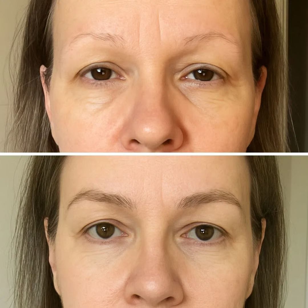 Customer photo review of IZABELL ROLLER - Roller for eyebrow regrowth