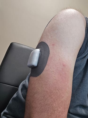 Customer photo review of Skin Grip Original - Omnipod Adhesive Patches