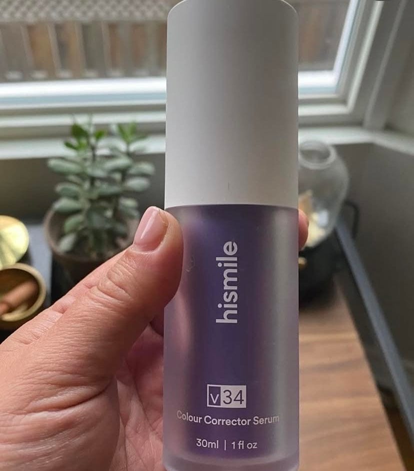Customer photo review of V34 Teeth Whitening Serum - (IMPORTED)
