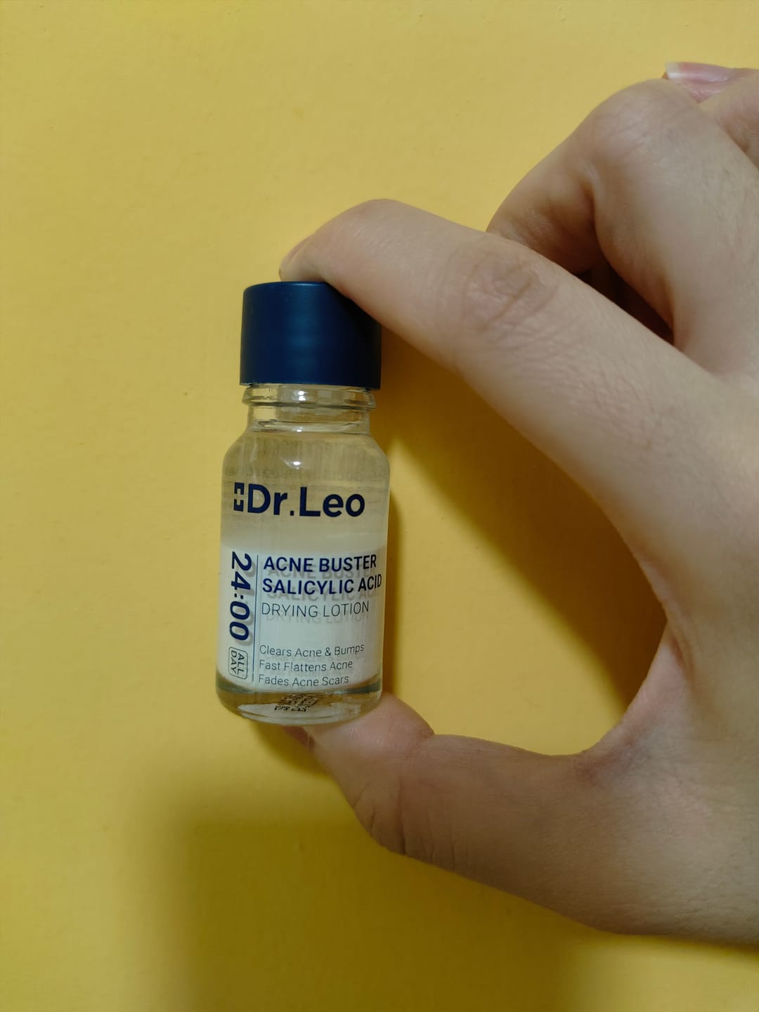 Customer photo review of Loción para el tratamiento del acné con ácido salicílico