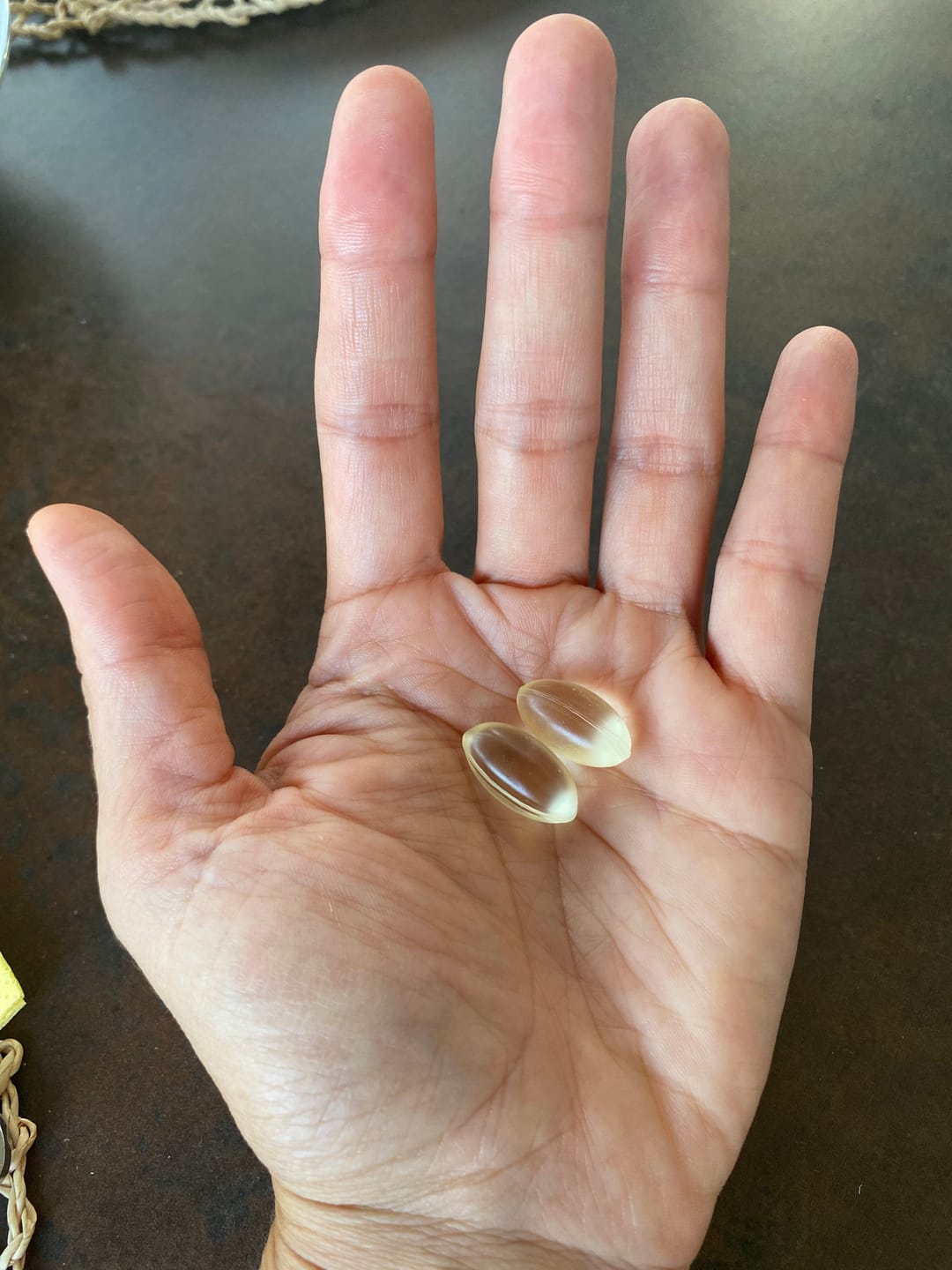 Customer photo review of Omega 3 Algenöl