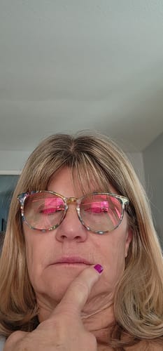 Customer photo review of 1 Month Supply - Deep Collagen Cream