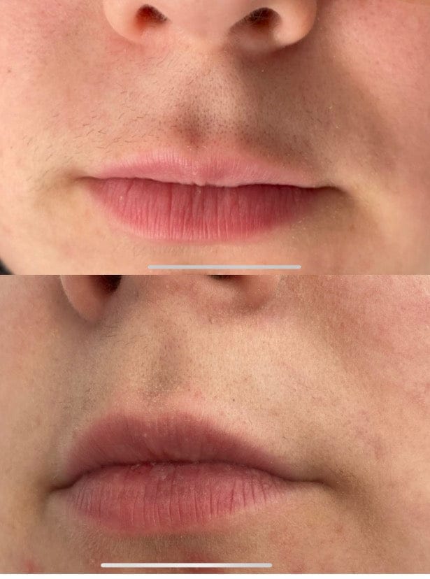 Customer photo review of AT Labs™ Масло Против Окосмяване