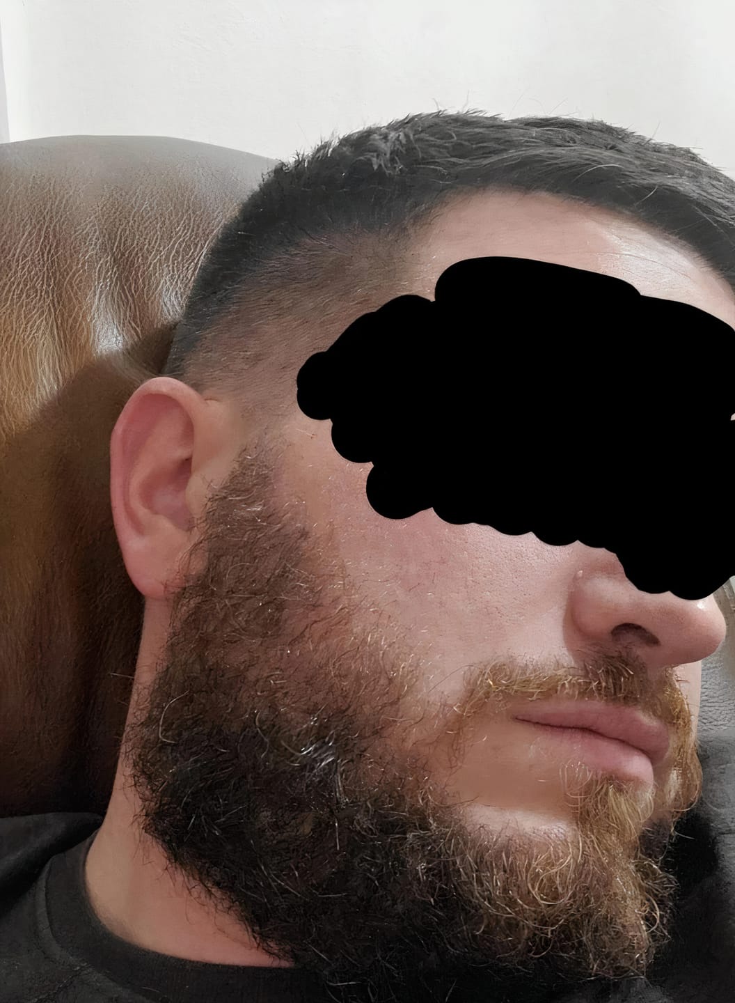 Customer photo review of Sérum Thorin | Huile de croissance de Barbe