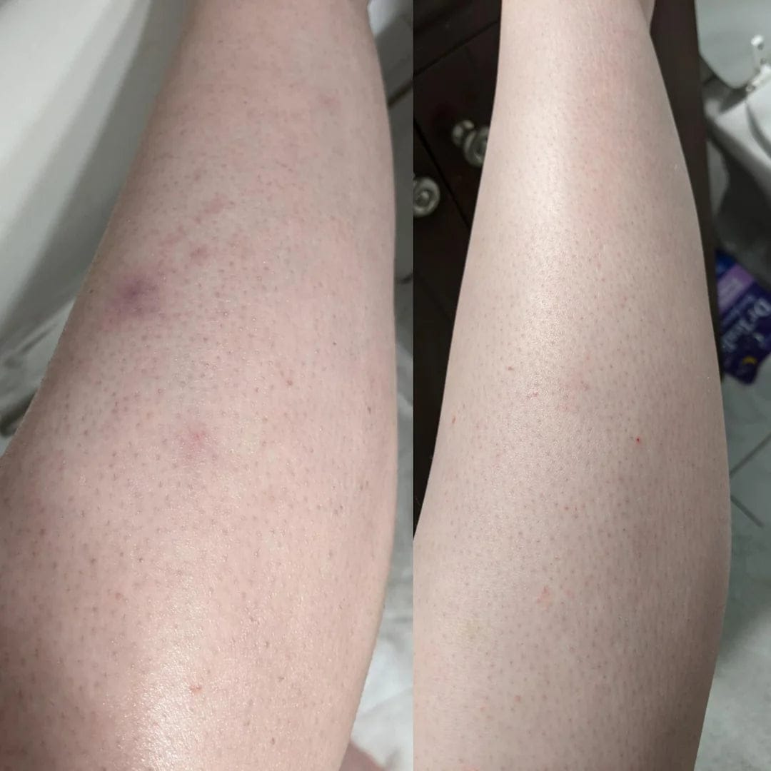Customer photo review of AT Labs™ Масло Против Окосмяване