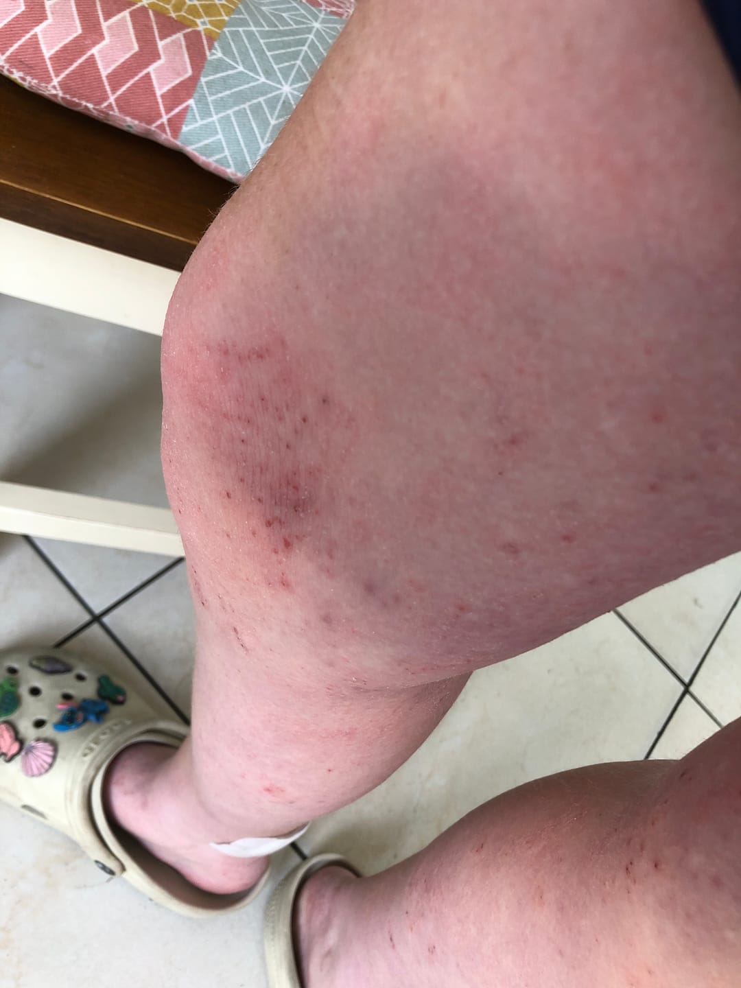 Customer photo review of Bioskin Junior Duo Pack