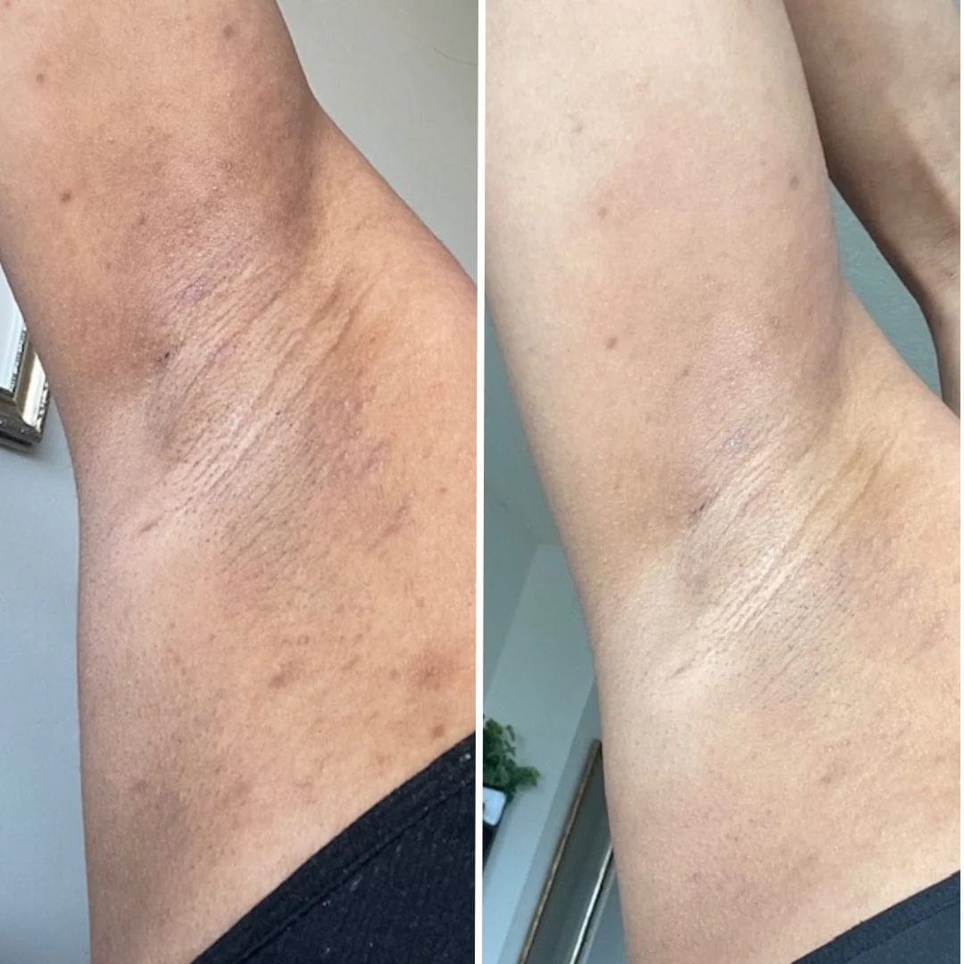 Customer photo review of AT Labs™ Масло Против Окосмяване