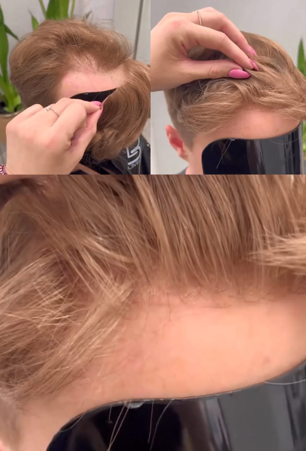 Customer photo review of Men Hair Topper Explorer|V-loop Hairline 0204mm