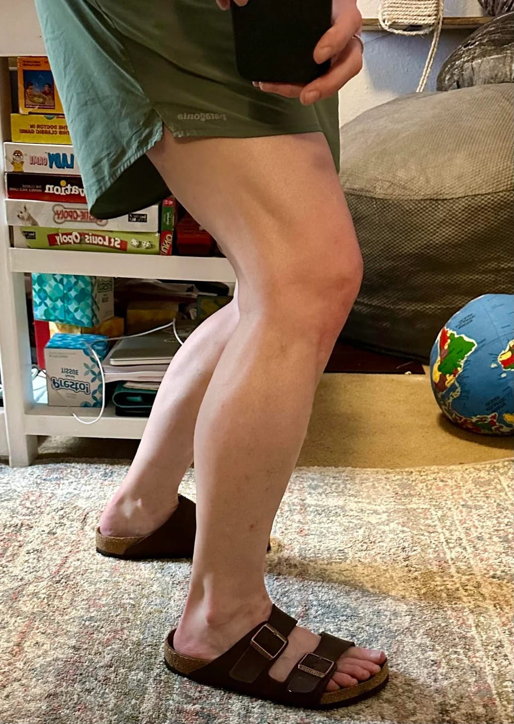 Customer photo review of Thermapulse - VeinErase System