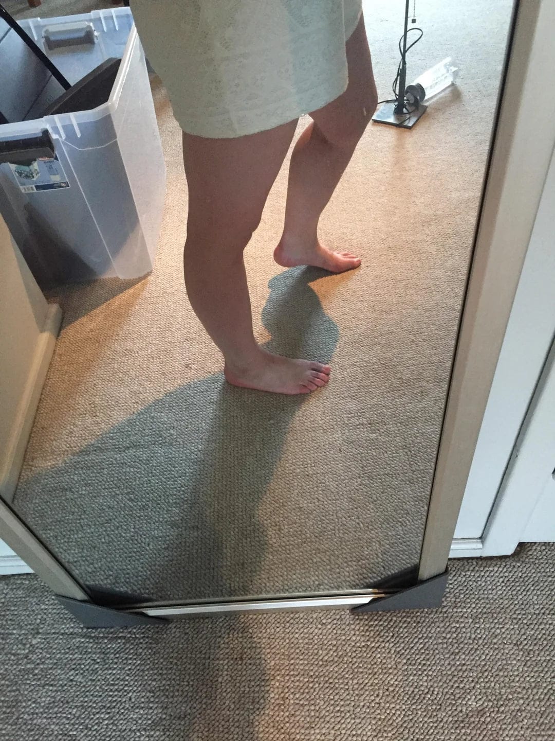Customer photo review of Thermapulse - VeinErase System