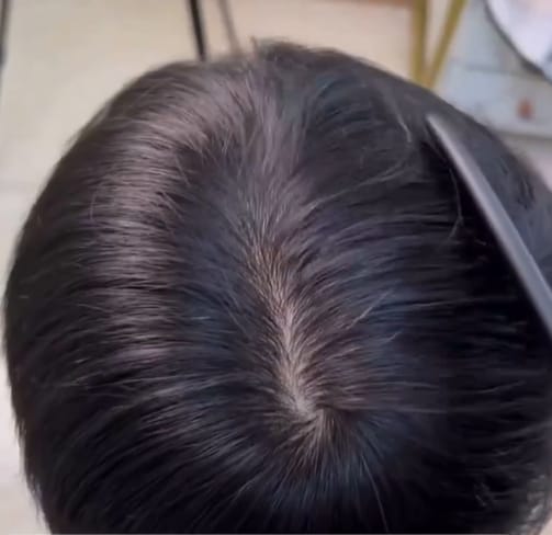Customer photo review of Toupee for Men HC Silk Top with PU around Base