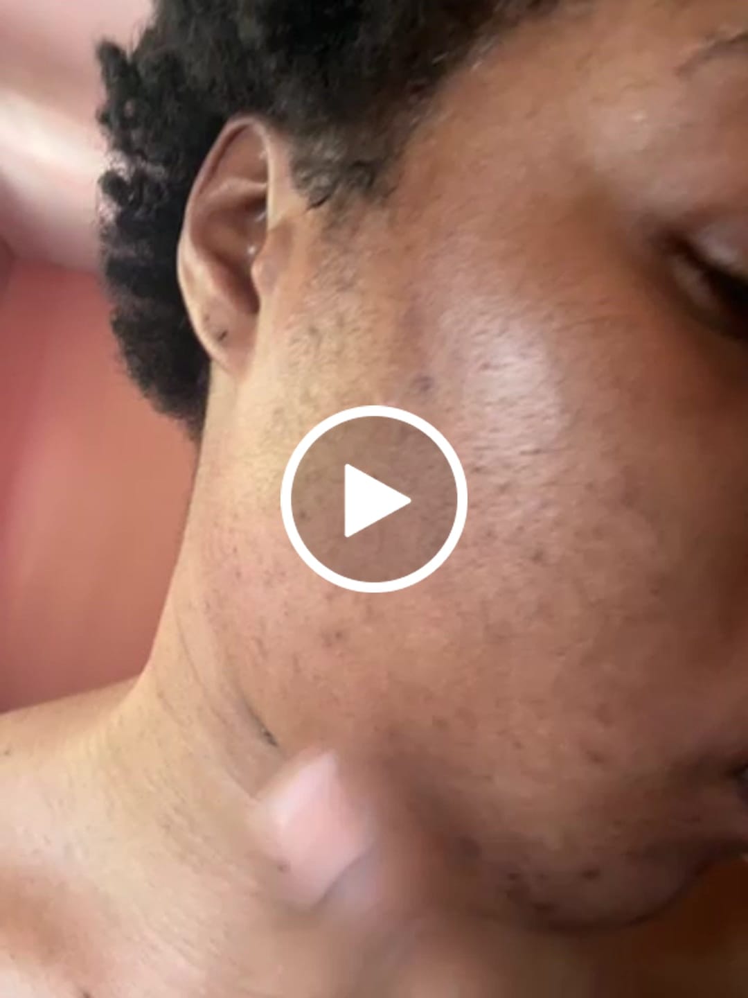 Customer video review of BIGGER EDITION: Jolie’s Full Body & Face Brightening / Acne Kit