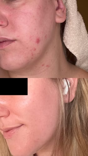 Customer photo review of Shower Water Softener System