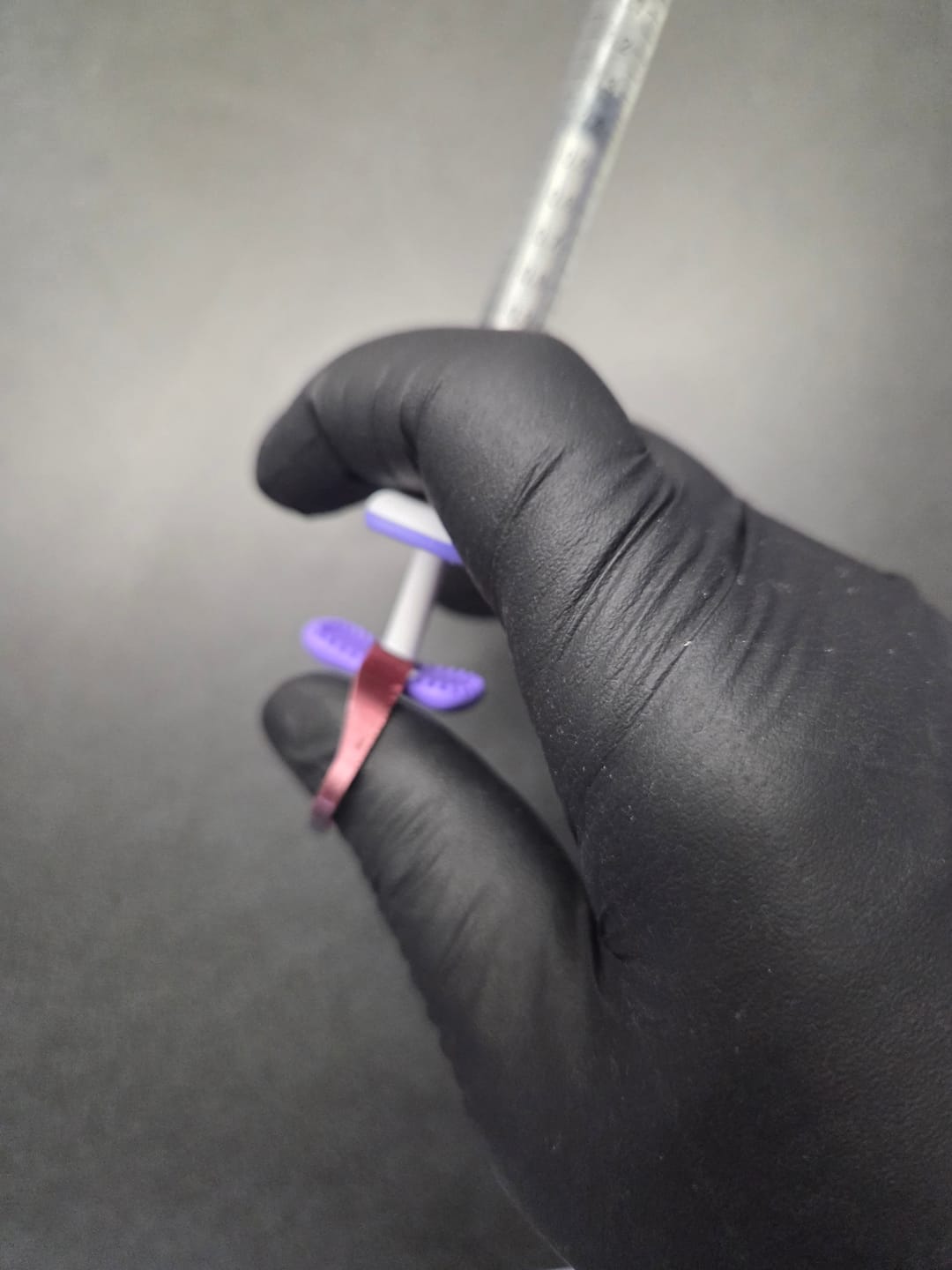 Customer photo review of Control Ring™ for Juvederm® Syringe | 10-Pack