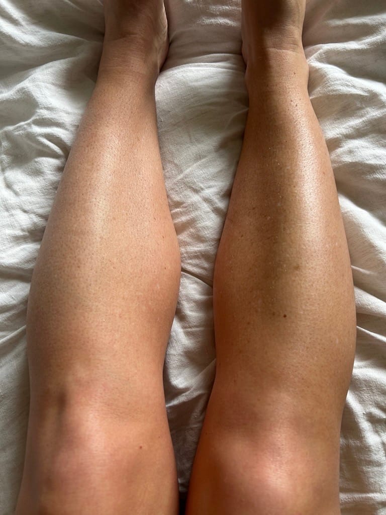 Customer photo review of Skin Renewing Body Elixir