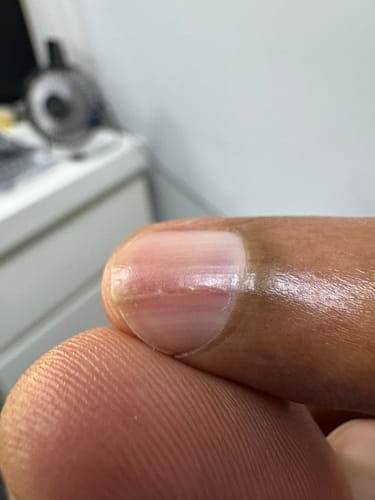 Customer photo review of Collagen 3 Month Supply (750g)