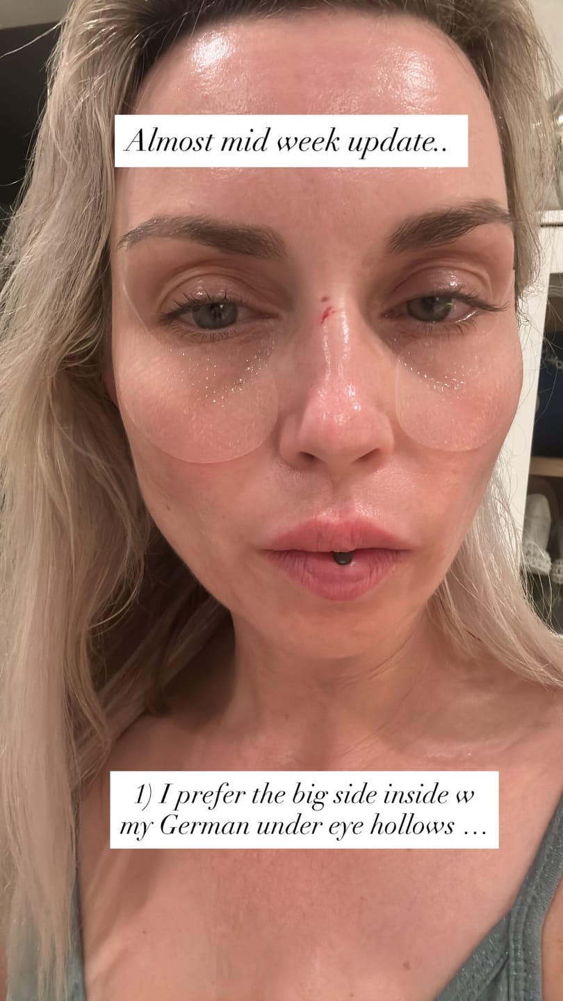 Customer photo review of Collagen eye patch Jericho rose jelly