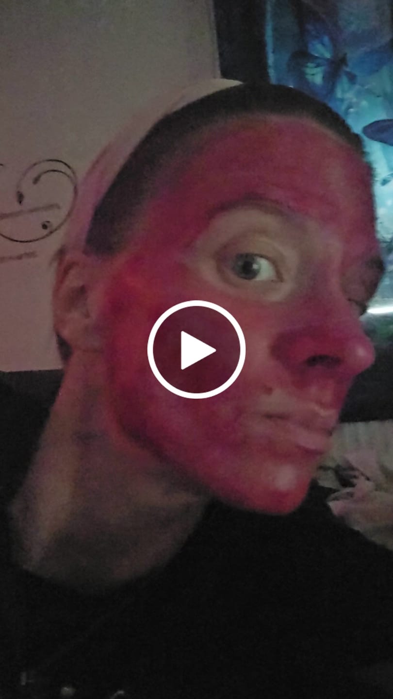 Customer video review of VAMPIRE PEEL® - Fruchtsäurepeeling
