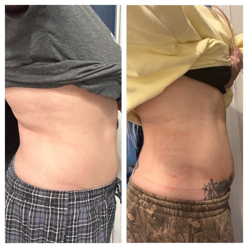 Customer photo review of DermaLux Pro