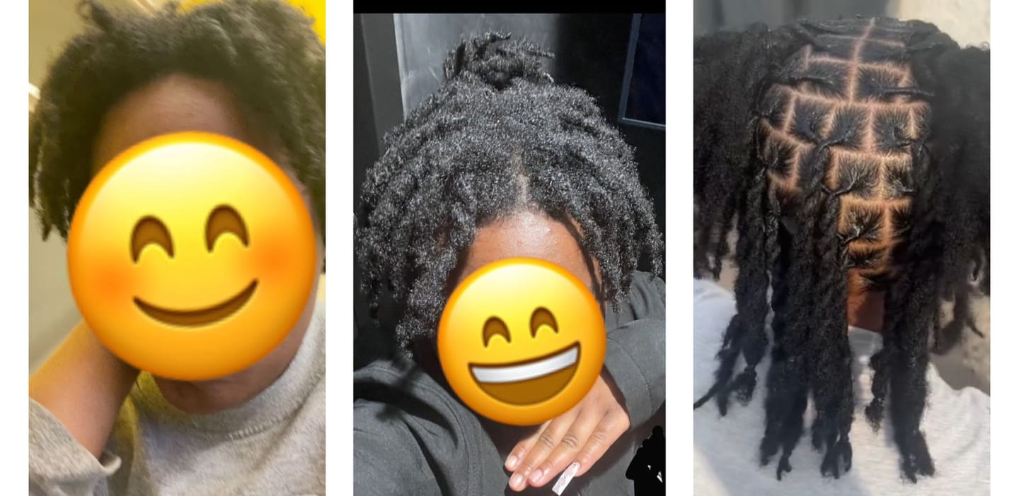 Customer photo review of 100% Natural Hair Growth / Thickening Oil